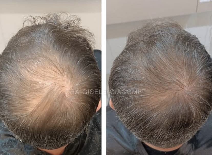 Antes e depois — saúde capilar