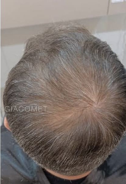 Saúde Capilar / Tricologia — resultado